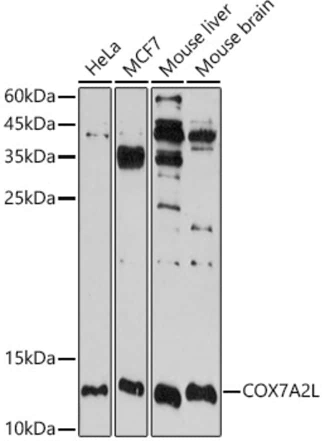 100UL COX7A2L ANTIBODY 100 ul