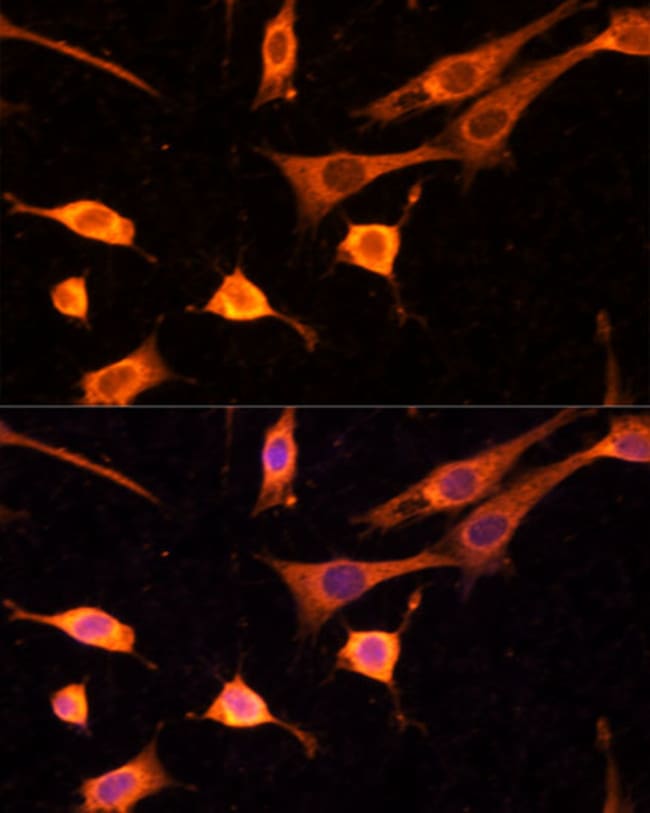 100UL BFAR ANTIBODY 100 ul