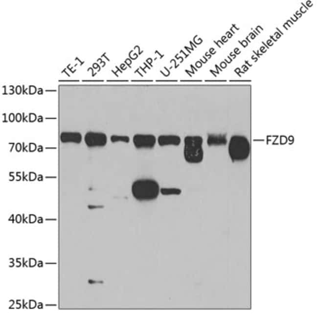 100UL FZD9 ANTIBODY 100 ul