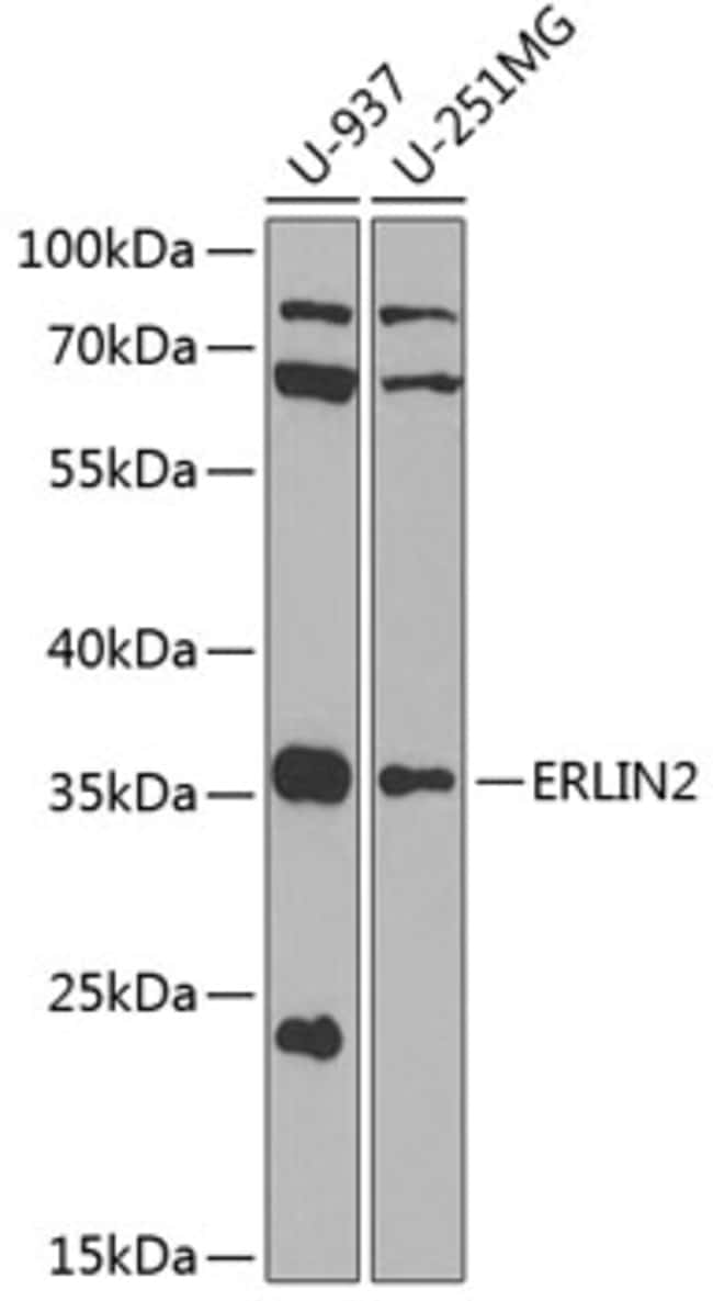 100UL ERLIN2 ANTIBODY 100 ul
