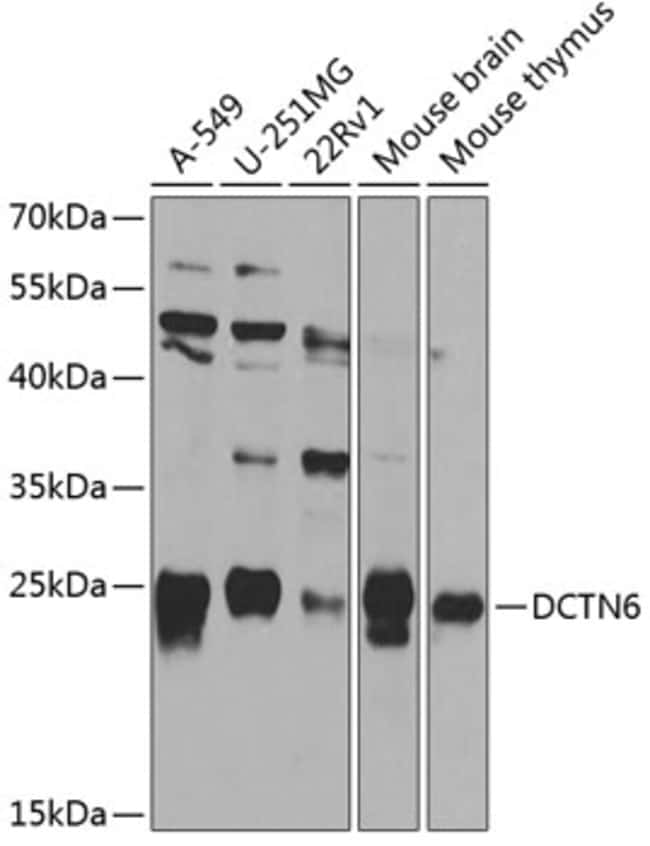 100UL DCTN6 ANTIBODY 100 ul