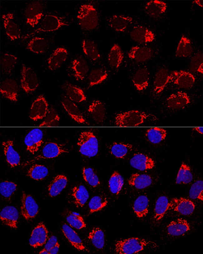 100UL AP1M2 ANTIBODY 100 ul
