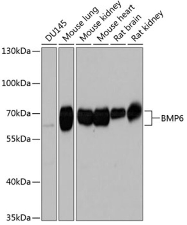 100UL BMP6 ANTIBODY 100 ul
