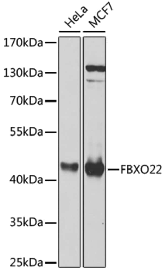 100UL FBXO22 ANTIBODY 100 ul