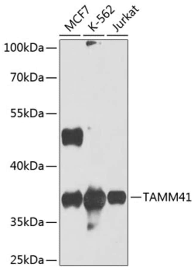 100UL C3ORF31 ANTIBODY 100 ul