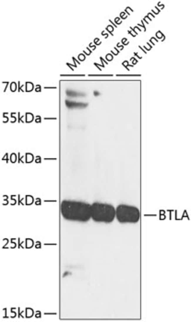 100UL BTLA ANTIBODY 100 ul