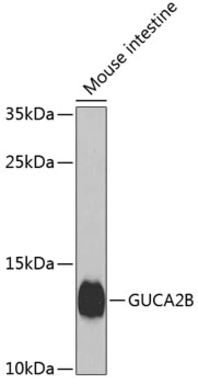 100UL GUCA2B ANTIBODY 100 ul