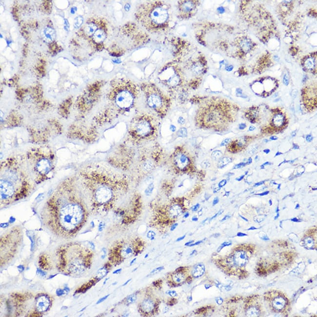 100UL AGXT ANTIBODY 100 ul