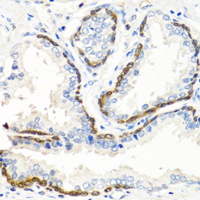 100UL BMP5 ANTIBODY 100 ul