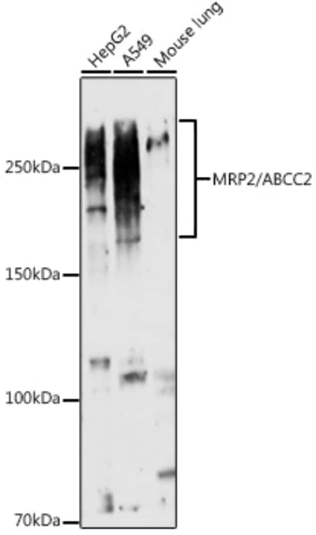 100UL MRP2 ANTIBODY 100 ul
