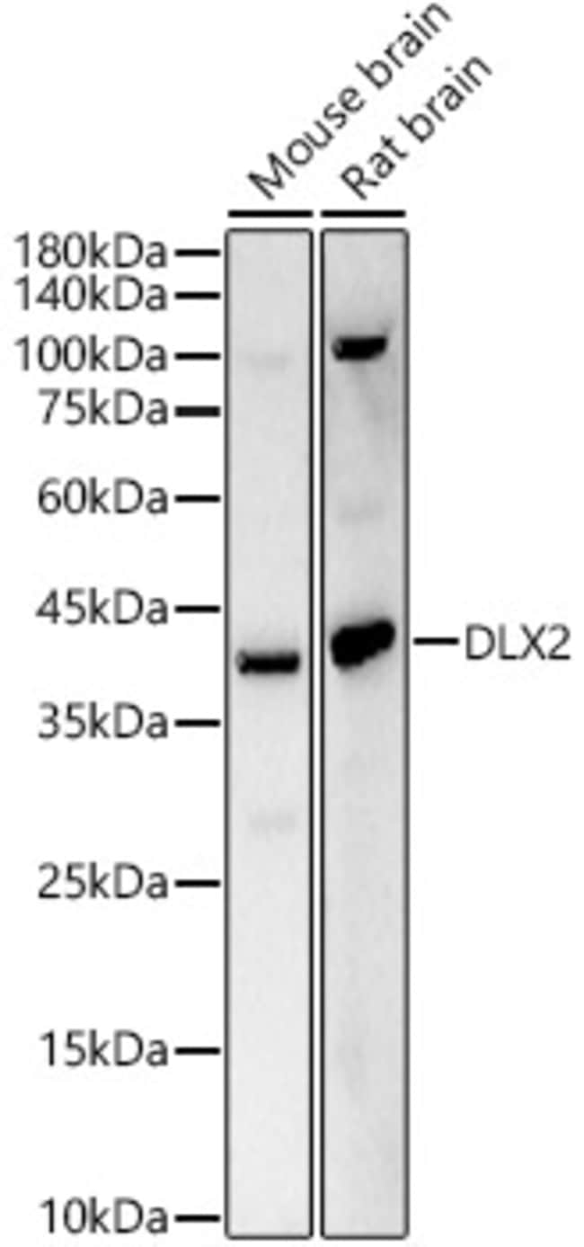 100UL DLX2 ANTIBODY 100 ul