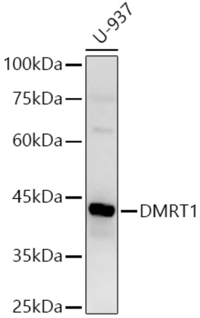 100UL DMRT1 ANTIBODY 100 ul