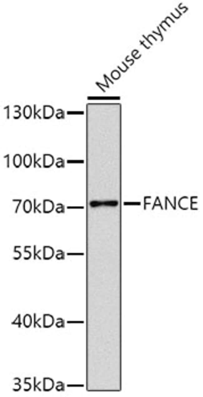 100UL FANCE ANTIBODY 100 ul