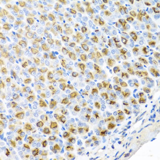 100UL FECH ANTIBODY 100 ul