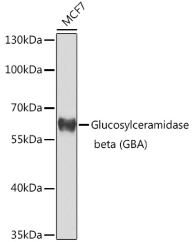 100UL GBA ANTIBODY 100 ul