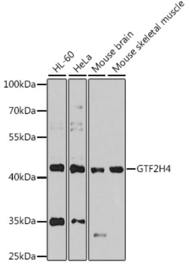 100UL GTF2H4 ANTIBODY 100 ul