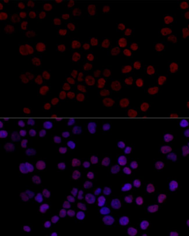 100UL HNRNP L ANTIBODY 100 ul