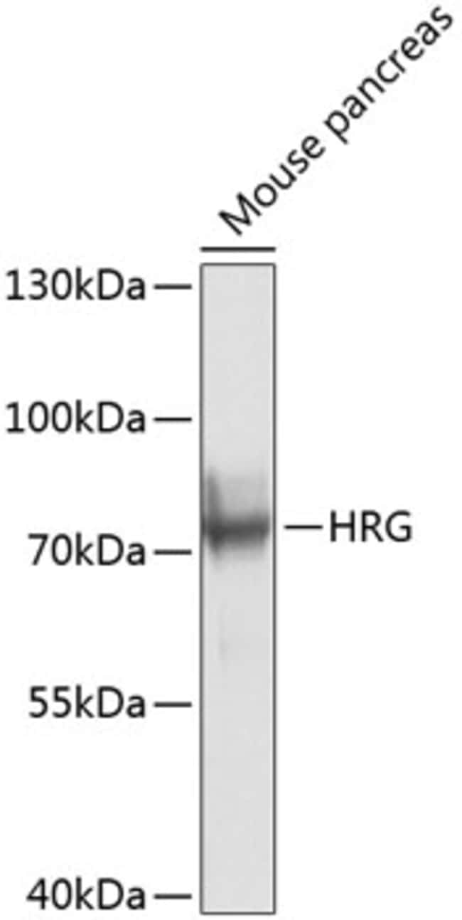 100UL HRG ANTIBODY 100 ul