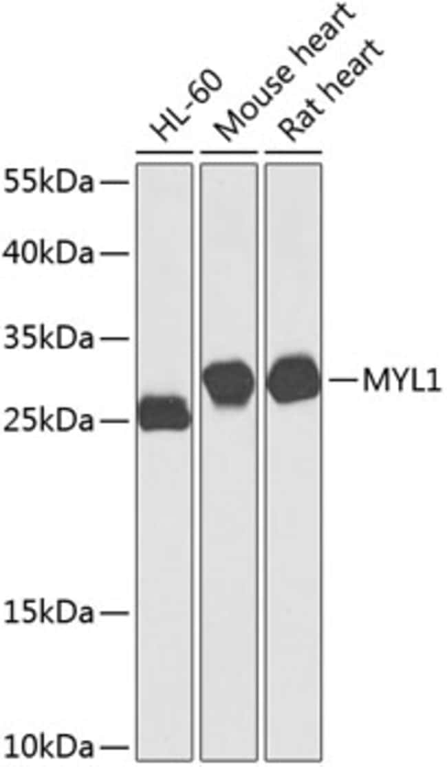 100UL MYL1 ANTIBODY 100 ul