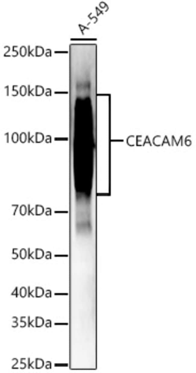 100UL CEACAM6 ANTIBODY 100 ul