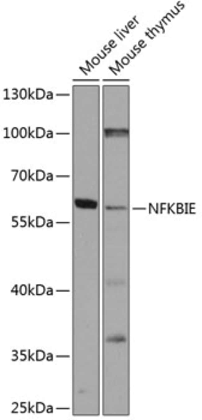 100UL IKB EPSILON ANTIBODY 100 ul