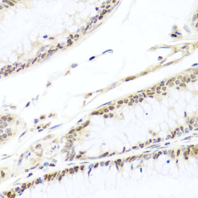 100UL HIRA ANTIBODY 100 ul