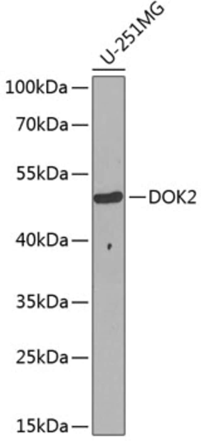 100UL DOK2 ANTIBODY 100 ul