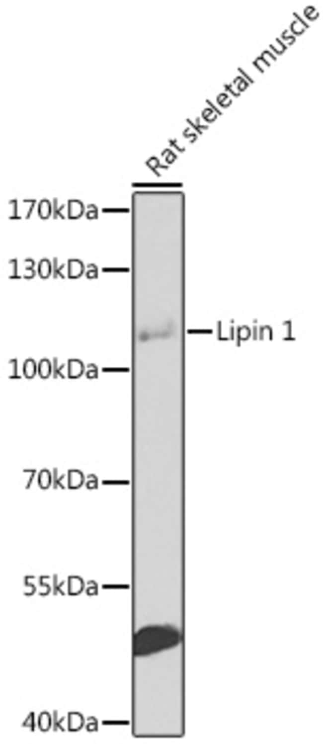 100UL LPIN1 ANTIBODY 100 ul