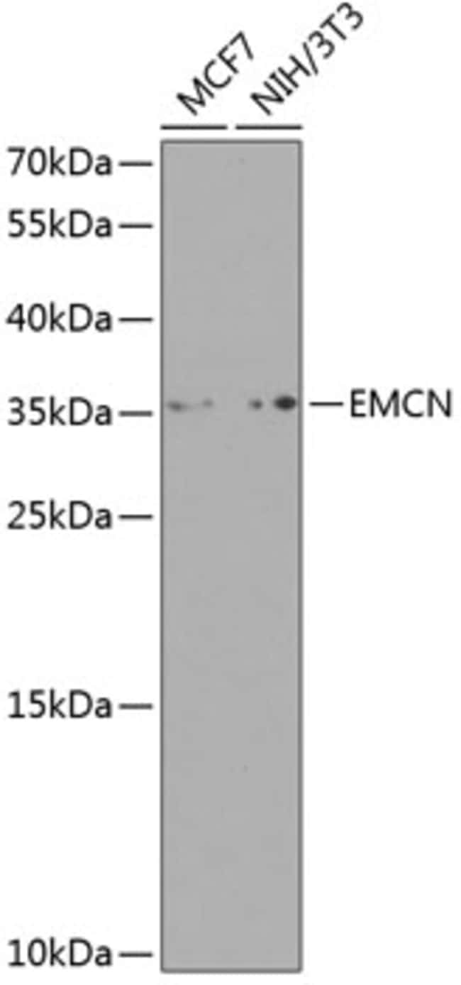 100UL ENDOMUCIN ANTIBODY 100 ul