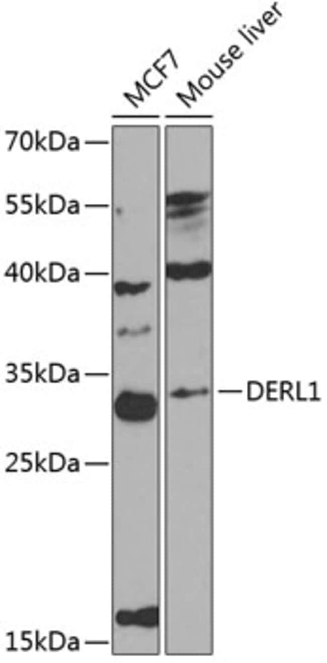 100UL DERL1 ANTIBODY 100 ul