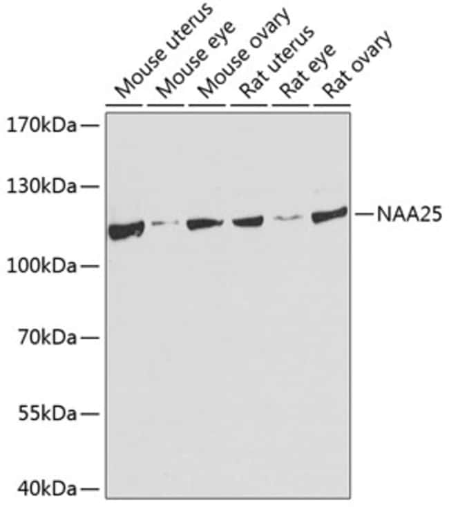 100UL C12ORF30 ANTIBODY 100 ul