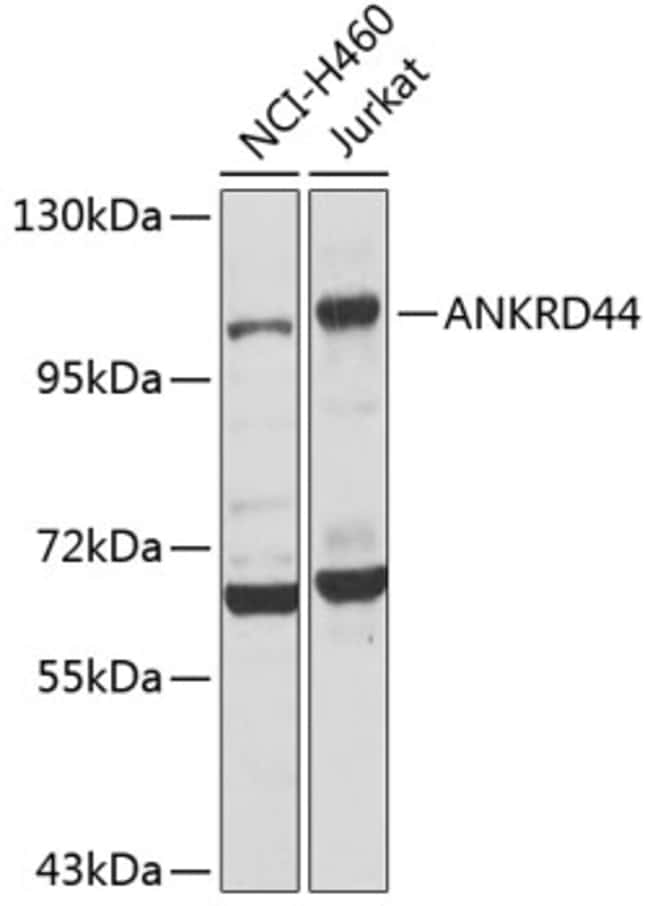 100UL ANR44 ANTIBODY 100 ul