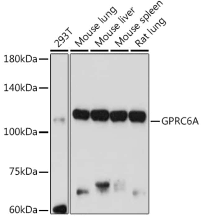 100UL GPRC6A ANTIBODY 100 ul