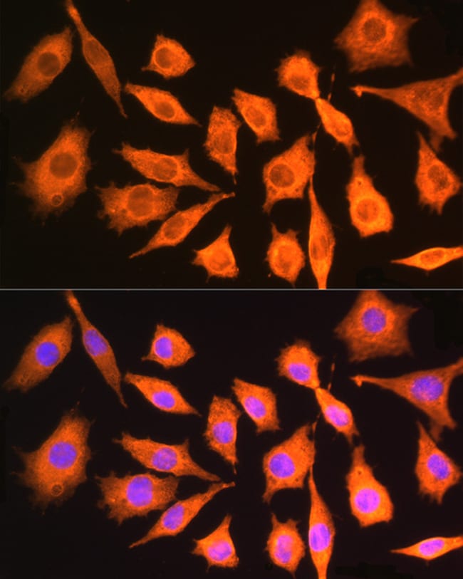 100UL CKAP5 ANTIBODY 100 ul