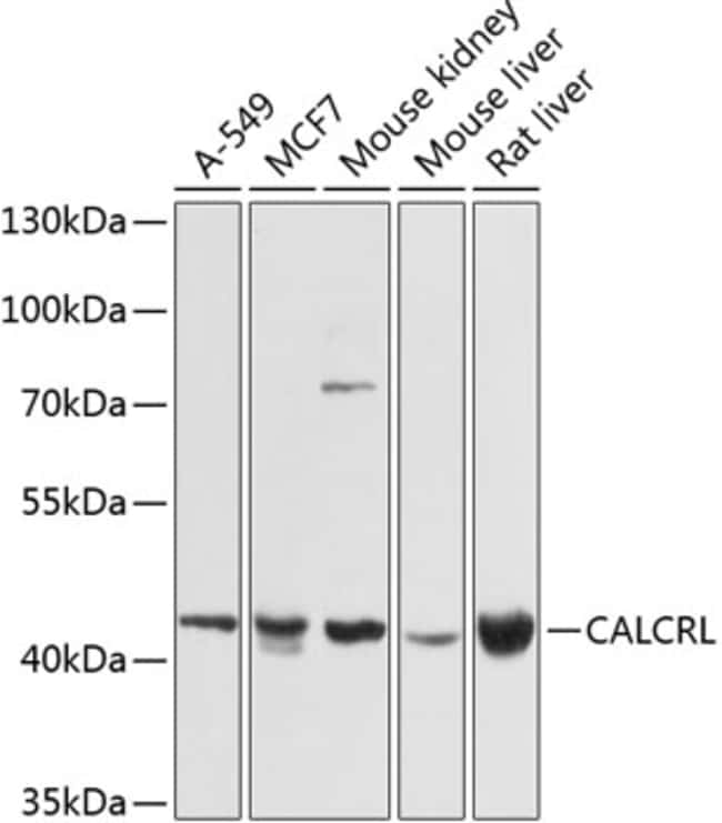 100UL CALCRL ANTIBODY 100 ul
