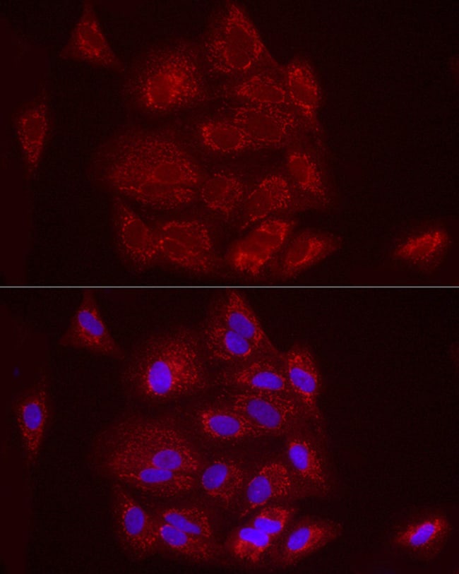 100UL FCGRT ANTIBODY 100 ul