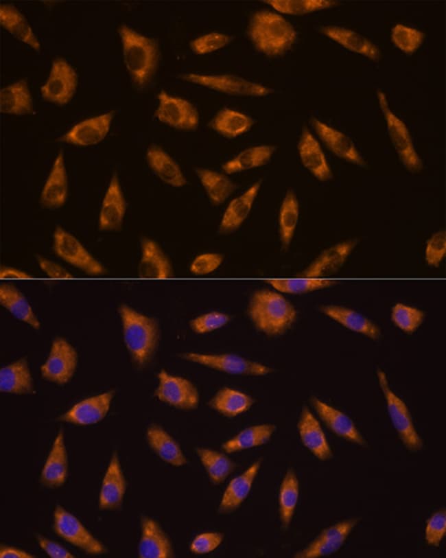 100UL GLP1R ANTIBODY 100 ul