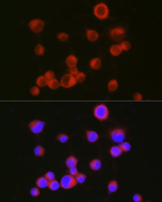 100UL CD171 ANTIBODY 100 ul