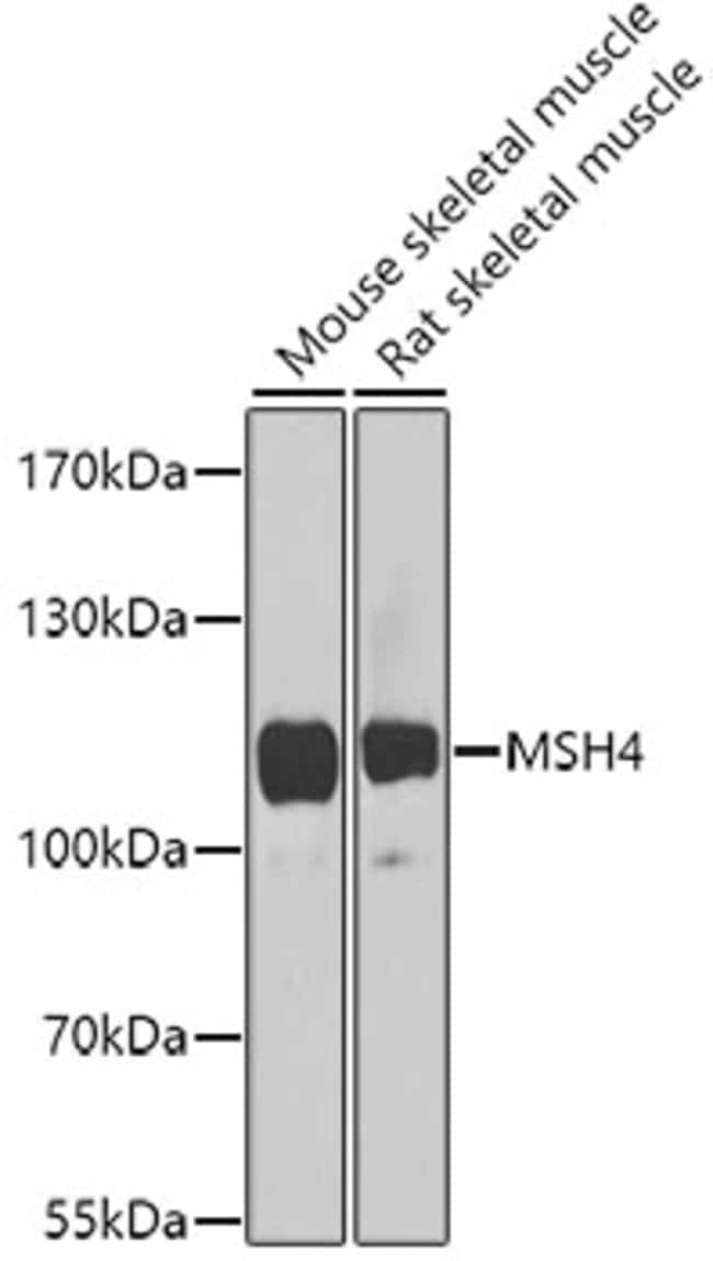 100UL MSH4 ANTIBODY 100 ul
