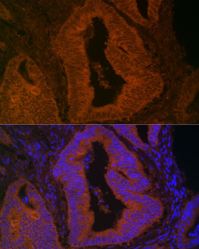 100UL MYO5B ANTIBODY 100 ul
