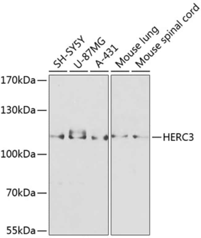 100UL HERC3 ANTIBODY 100 ul