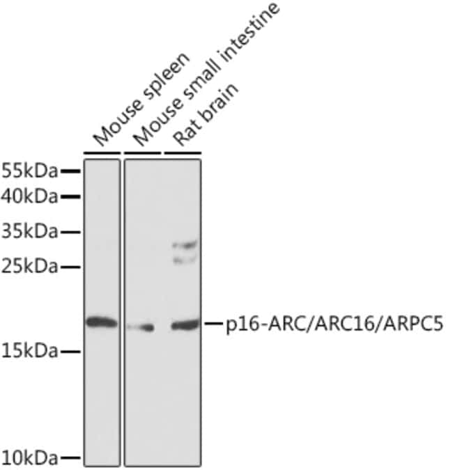 100UL ARPC5 ANTIBODY 100 ul
