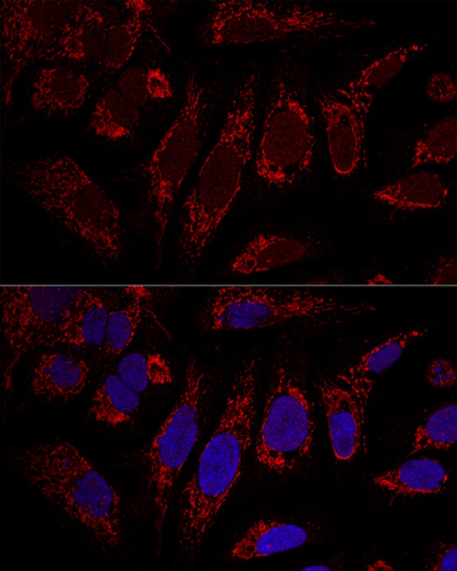 100UL CHCHD3 ANTIBODY 100 ul