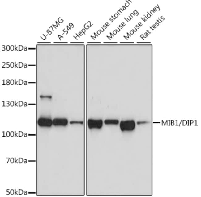 100UL MIB1 ANTIBODY 100 ul