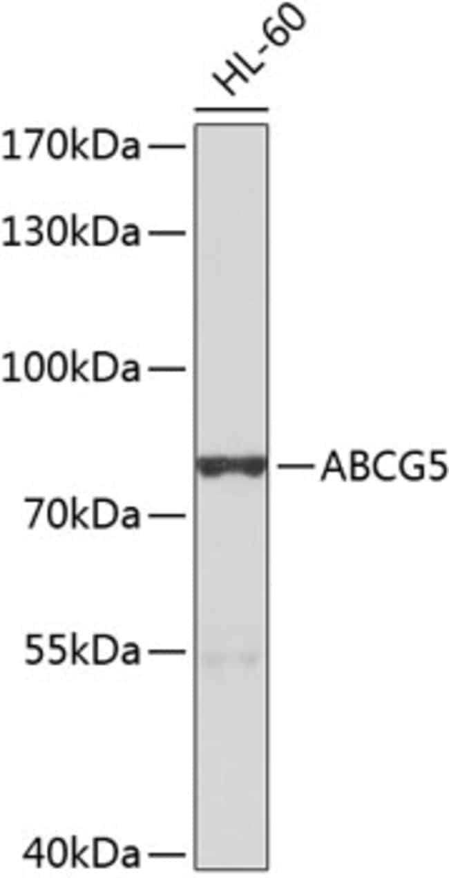 100UL ABCG5 ANTIBODY 100 ul