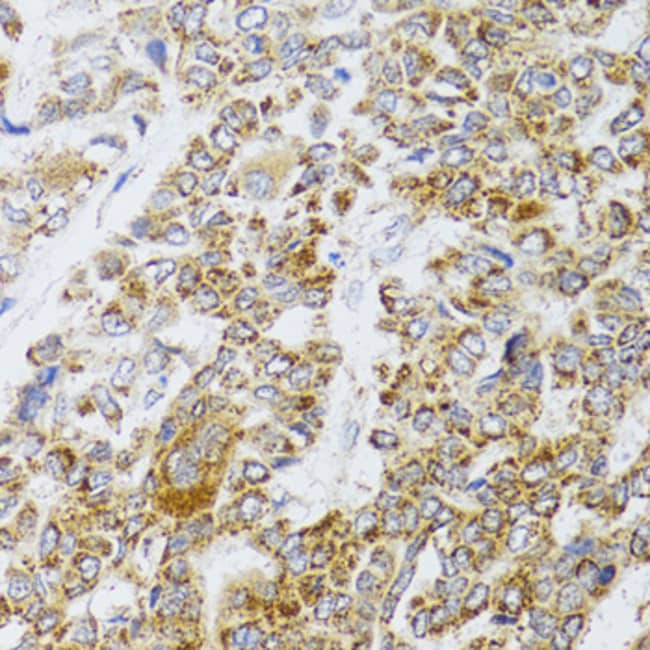 100UL AIFM3 ANTIBODY 100 ul
