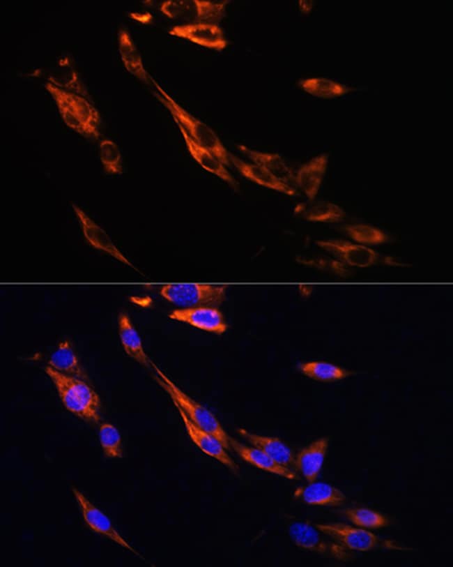 100UL BETA-3 ADRENERGIC RECEPTOR ANT 100