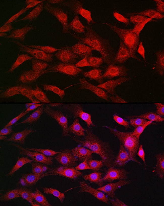 100UL IMPORTIN BETA-1 ANTIBODY 100 ul