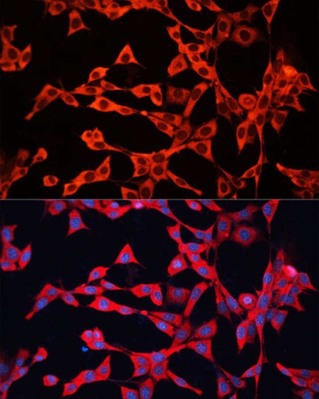 100UL GDI2 ANTIBODY 100 ul