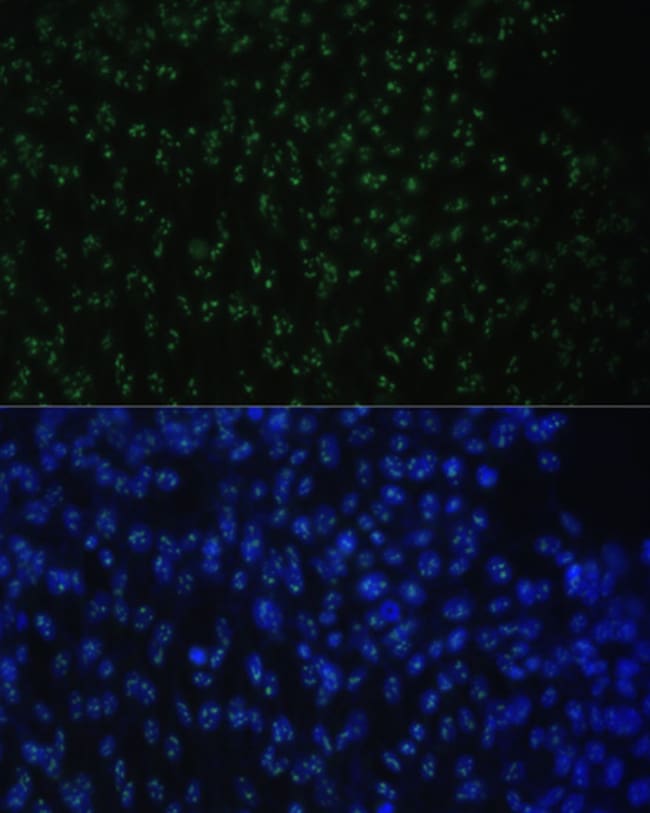 100UL DDX50 ANTIBODY 100 ul